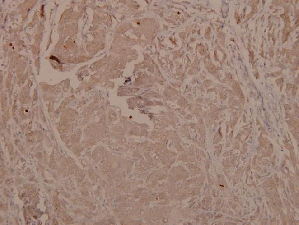 a03152y279 gsk3a primary antiboties ihc testing 2