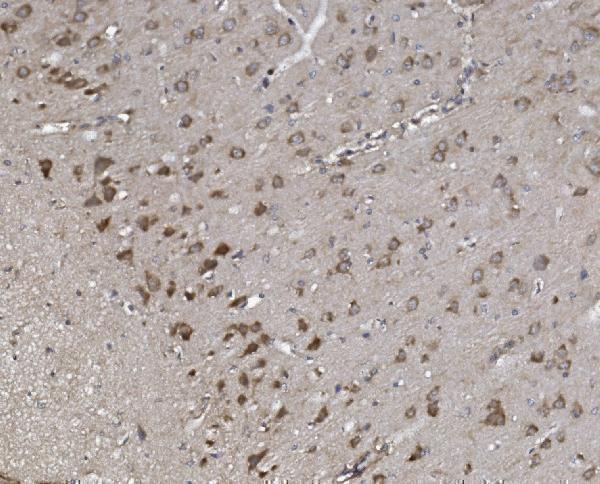  IHC analysis of Synaptopodin/SYNPO using anti-Synaptopodin/SYNPO antibody (A03154-1)