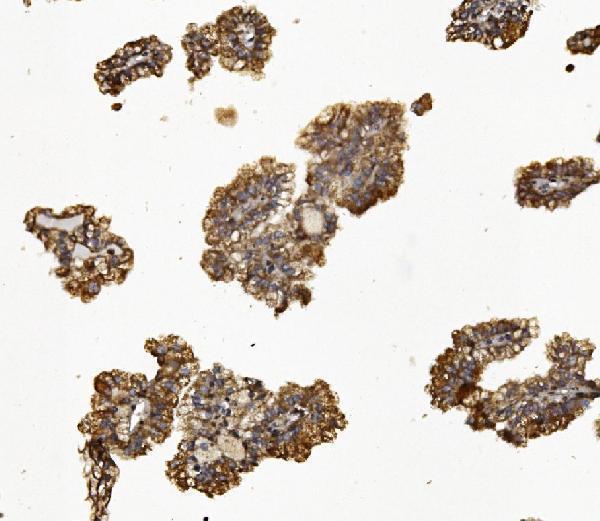 IHC analysis of Synaptopodin/SYNPO using anti-Synaptopodin/SYNPO antibody (A03154-1)