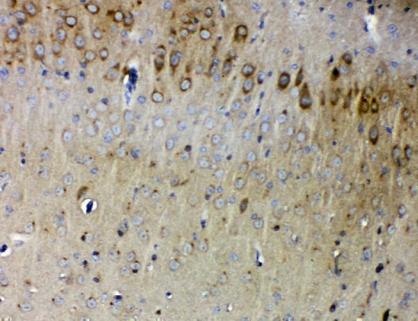 a03154 1 synpo primary antibodies ihc testing 6