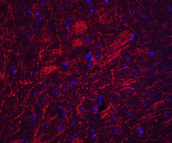 a03154 synpo primary antibodies if testing 4