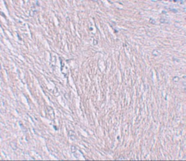Immunohistochemistry of SYNPO in human brain tissue with SYNPO antibody at 2