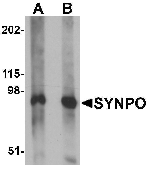 Western blot analysis of SYNPO in rat brain tissue lysate with SYNPO antibody at (A) 1 and (B) 2 μg/mL