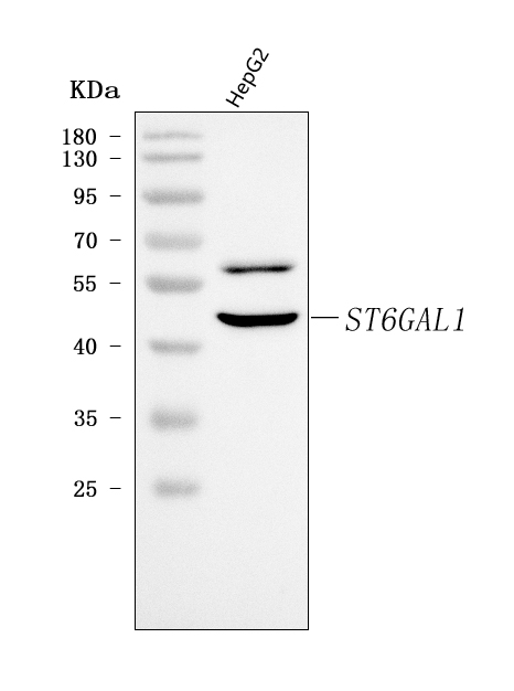  Western blot analysis of CDw75/ST6GAL1 using anti-CDw75/ST6GAL1 antibody (A03156-1)