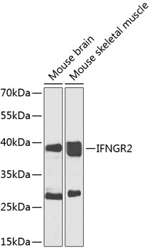 Western blot analysis of extracts of various cell lines, using IFNGR2 antibody  at 1:1000 dilution
