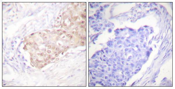 a03160 ubr5 primary antibodies ihc testing 1