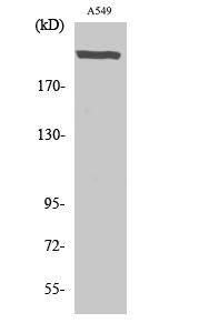 Western Blot analysis of various cells using UBR5 Polyclonal Antibody