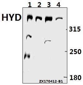 Western blot (WB) analysis of HYD (T14) polyclonal antibody at 1:500 dilution
Lane1:CT26 whole cell lysate(40ug)
Lane2:PC12 whole cell lysate(40ug)
Lane3:HEK293T whole cell lysate(40ug)
Lane4:HK-2 whole cell lysate(40ug)