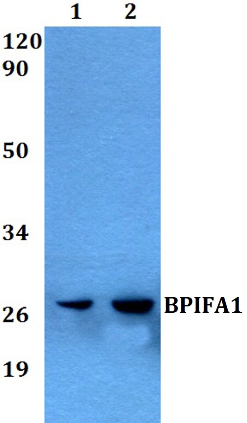 Western blot (WB) analysis of BPIFA1 polyclonal antibody at 1:500 dilution
Lane1:A549 whole cell lysate
Lane2:PC12 whole cell lysate 