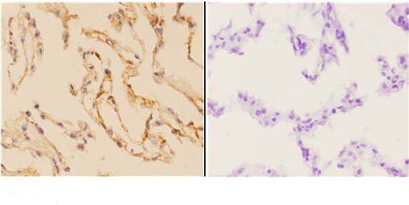 a03163 1 abca7 primary antiboties ihc testing 2