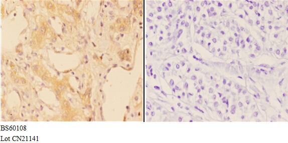 a03163 1 abca7 primary antiboties ihc testing 3