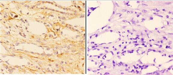 a03163 1 abca7 primary antiboties ihc testing 4
