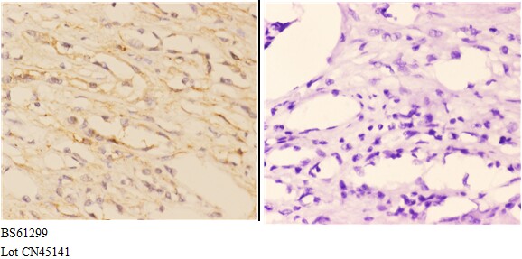 a03163 2 abca7 primary antiboties ihc testing 3