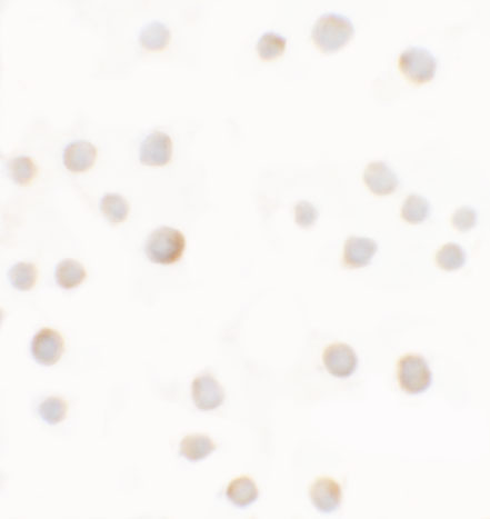 a03163 abca7 primary antibodies icc testing 4
