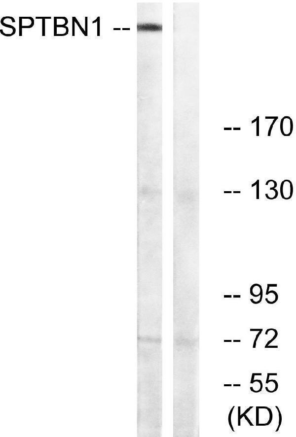 Western blot analysis of lysates from COLO cells, using SPTBN1 Antibody
