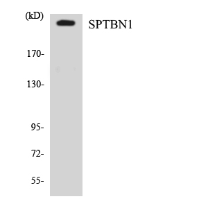 Western blot analysis of the lysates from Jurkat cells using SPTBN1 antibody