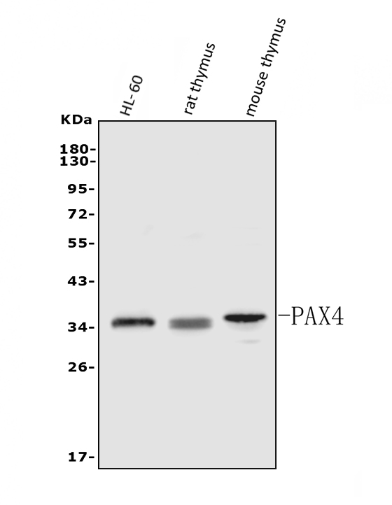  Western blot analysis of PAX4 using anti-PAX4 antibody (A03165-2)