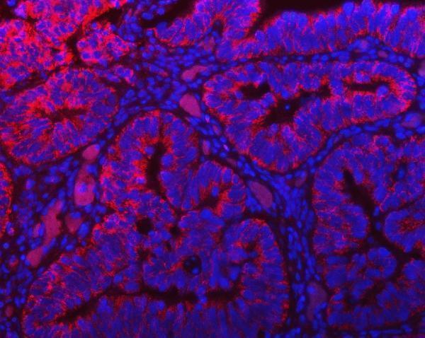 a03166 2 tomm40 primary antibodies if testing 10