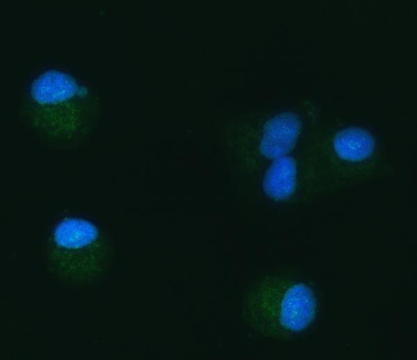 a03166 2 tomm40 primary antibodies if testing 8