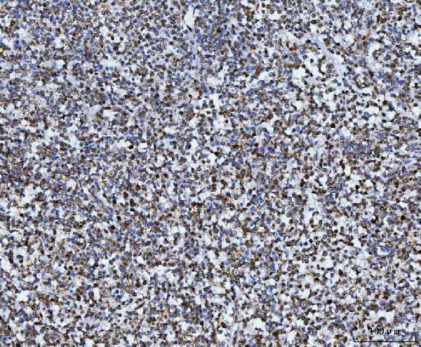  IHC analysis of TOMM40 using anti-TOMM40 antibody (A03166-2)