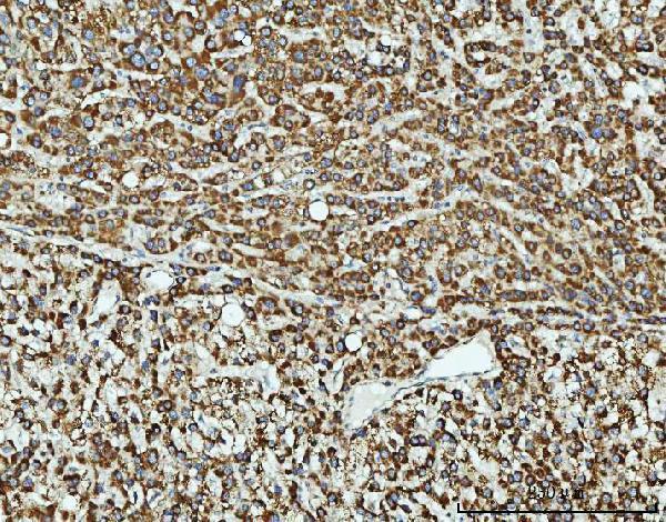  IHC analysis of TOMM40 using anti-TOMM40 antibody (A03166-2)