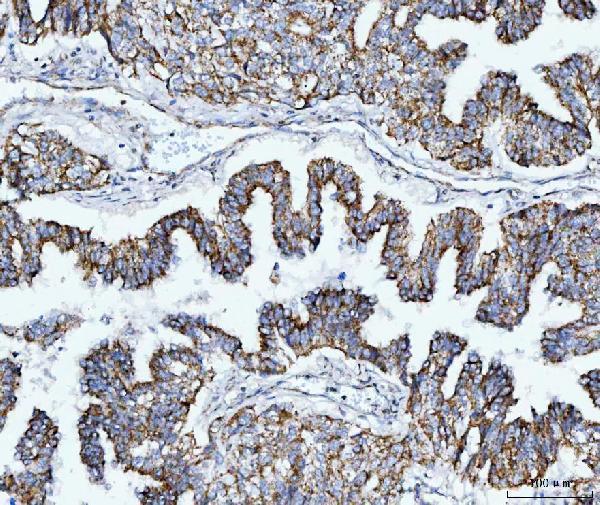 a03166 2 tomm40 primary antibodies ihc testing 4