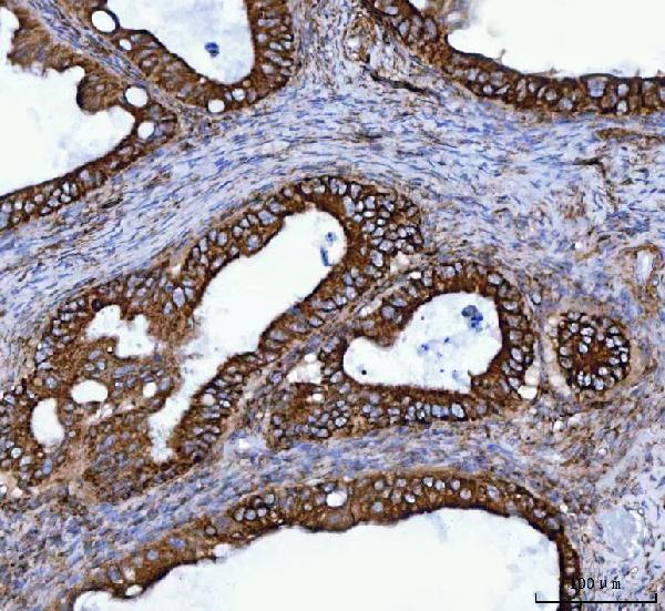 a03166 2 tomm40 primary antibodies ihc testing 5