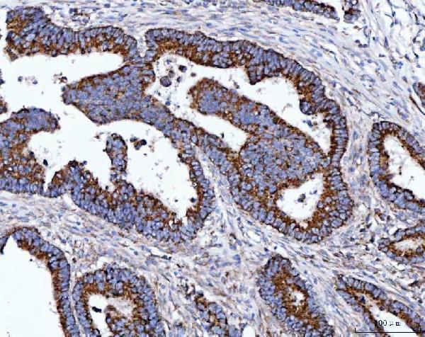 a03166 2 tomm40 primary antibodies ihc testing 6