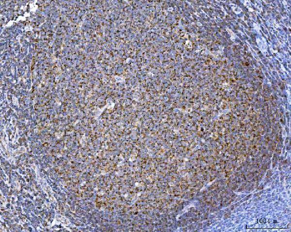 a03166 2 tomm40 primary antibodies ihc testing 7