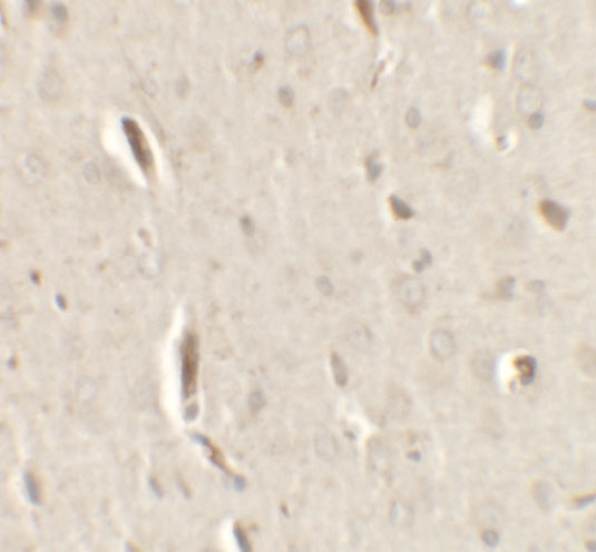 a03167 grip1 primary antibodies ihc testing 2