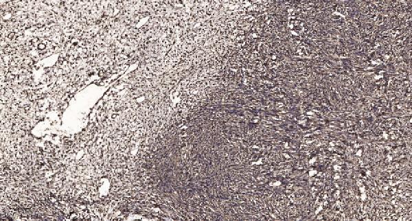 Immunohistochemical analysis of paraffin-embedded human oophoroma