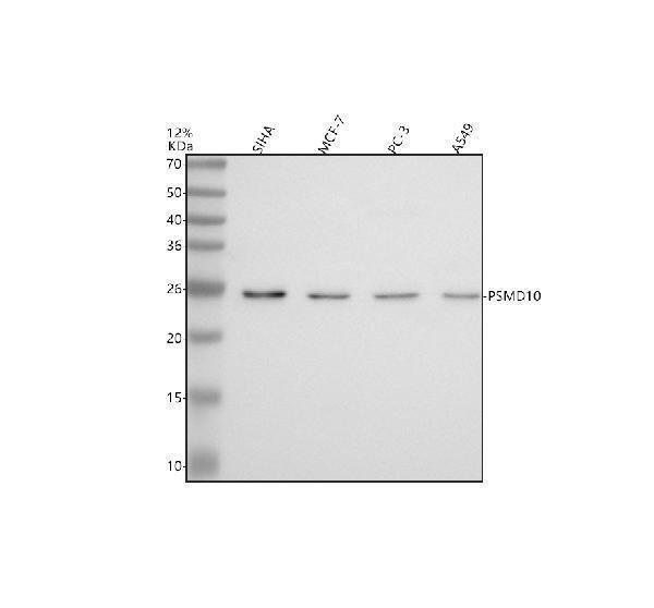  Western blot analysis of Gankyrin/PSMD10 using anti-Gankyrin/PSMD10 antibody (A03169-2)