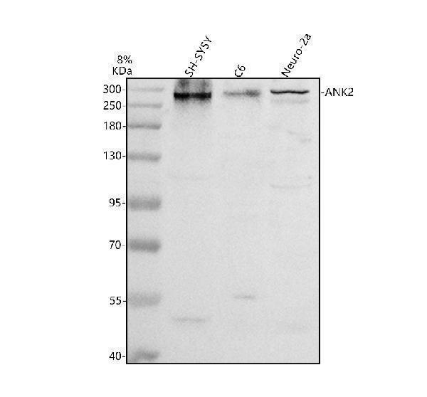 Western blot analysis of ANK2 using anti-ANK2 antibody (A03171)