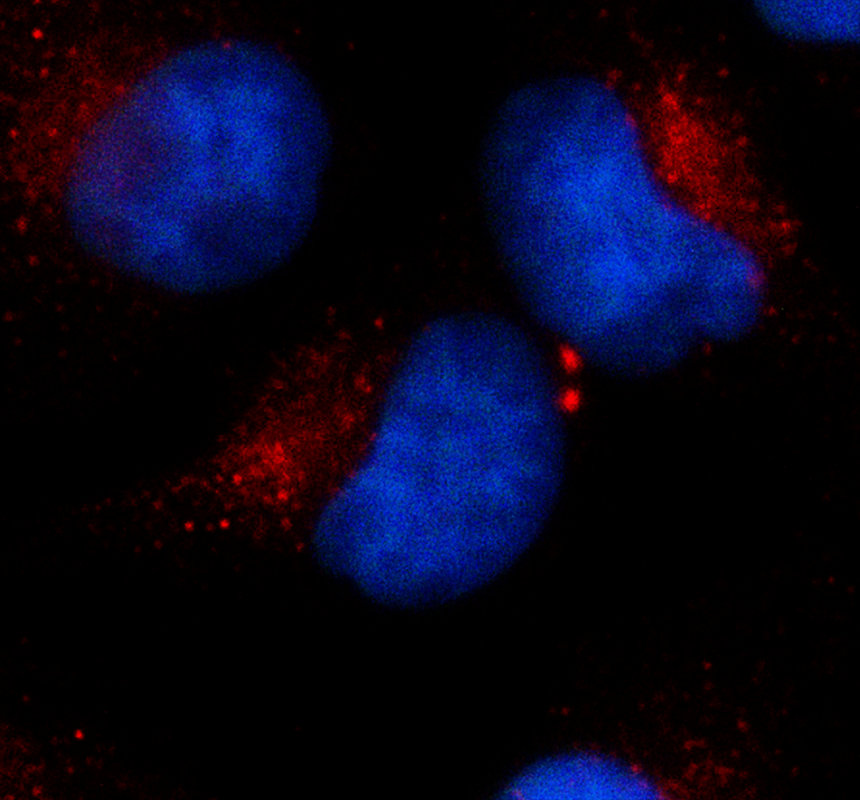 a03173 mkks primary antibodies if testing 1