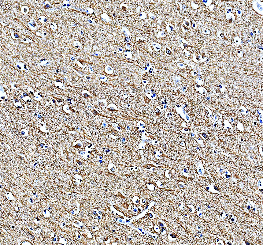 a03173 mkks primary antibodies ihc testing 1