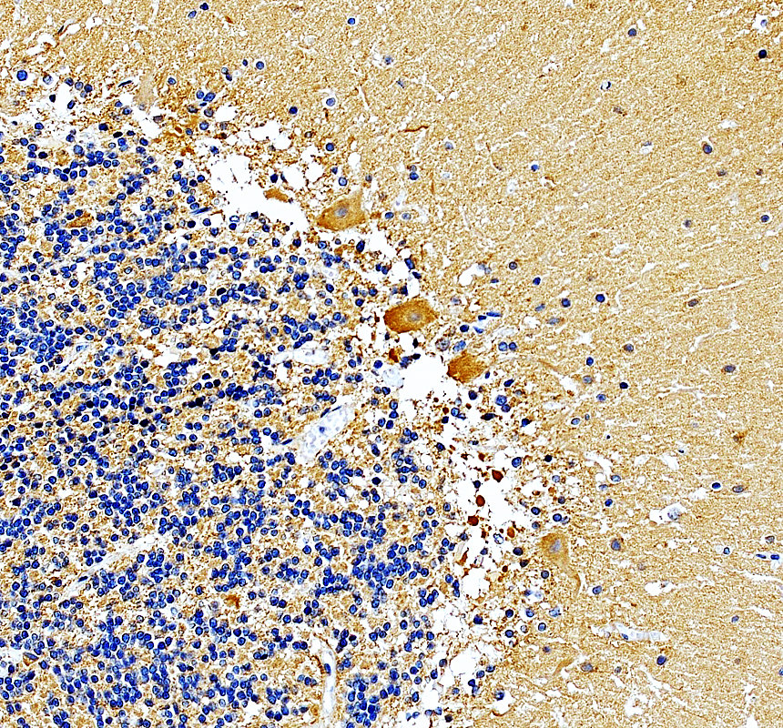 a03173 mkks primary antibodies ihc testing 2