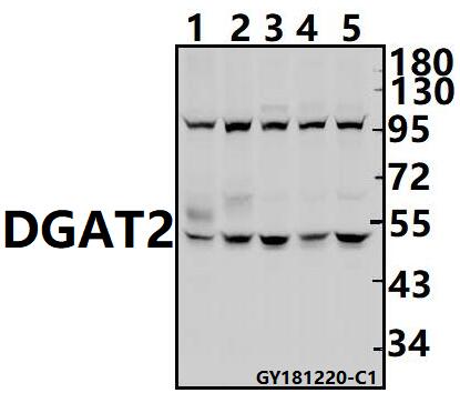a03174 dgat2 primary antiboties wb testing 1