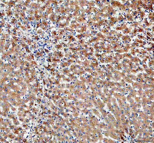 IHC analysis of PDZK1 using anti-PDZK1 antibody (A03176-1)