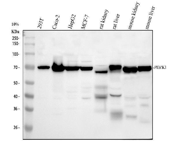 Western blot analysis of PDZK1 using anti-PDZK1 antibody (A03176-1)