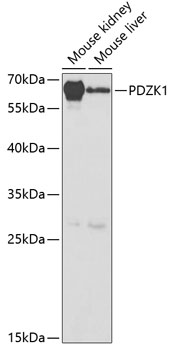 Western blot analysis of extracts of various cell lines, using PDZK1 antibody  at 1:1000 dilution