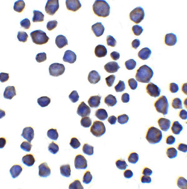 Immunocytochemistry of Chondroadherin in 3T3 cells with Chondroadherin antibody at 5 μg/ml