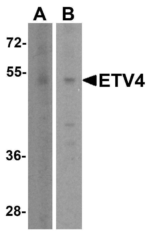 a03184 1 etv4 primary antibodies wb testing 1