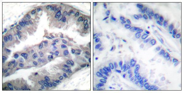 a03188t33 bik primary antibodies ihc testing 3
