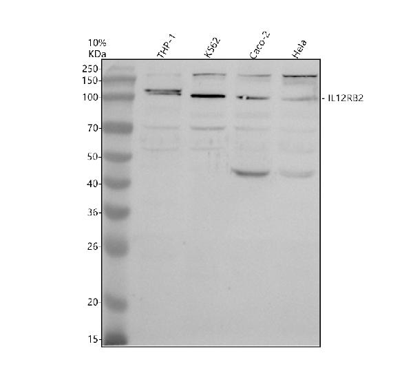 a03189 2 il12rb2 primary antibodies wb testing 1