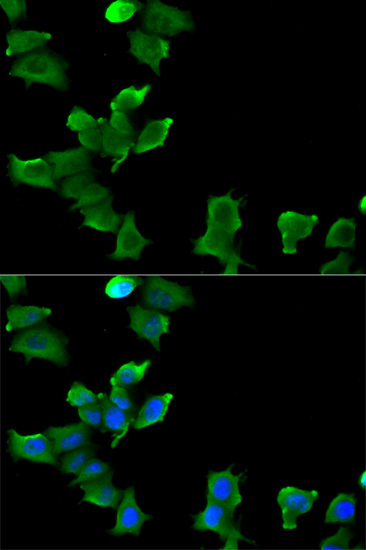 a03191 1 glul primary antiboties ihc testing 3