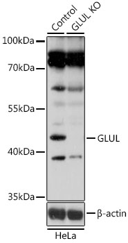 a03191 1 glul primary antiboties ihc testing 4