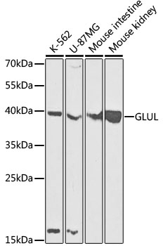 a03191 1 glul primary antiboties wb testing 1