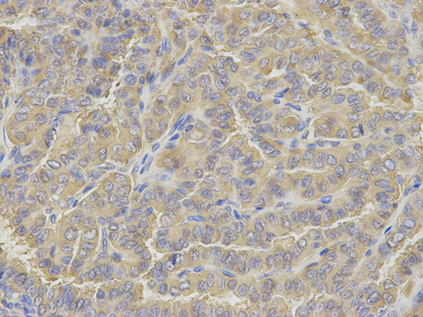 a03191 1 glul primary antiboties wb testing 2