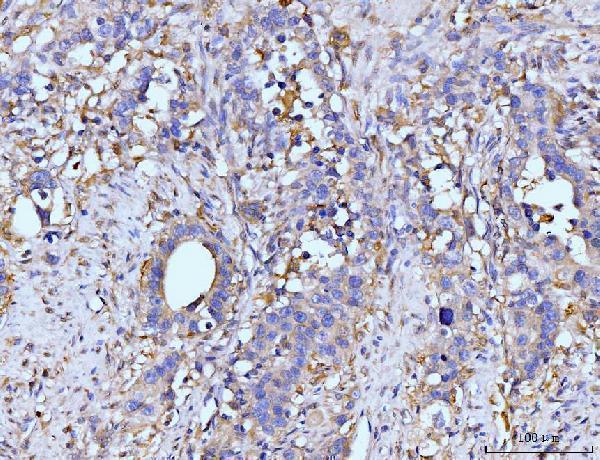  IHC analysis of GLUL using anti-GLUL antibody (A03191-3)