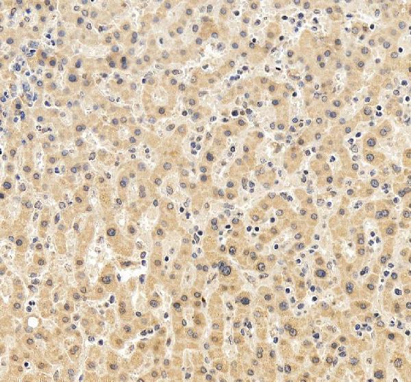 IHC analysis of Glutamine Synthetase/GLUL using anti-Glutamine Synthetase/GLUL antibody (A03191-3)